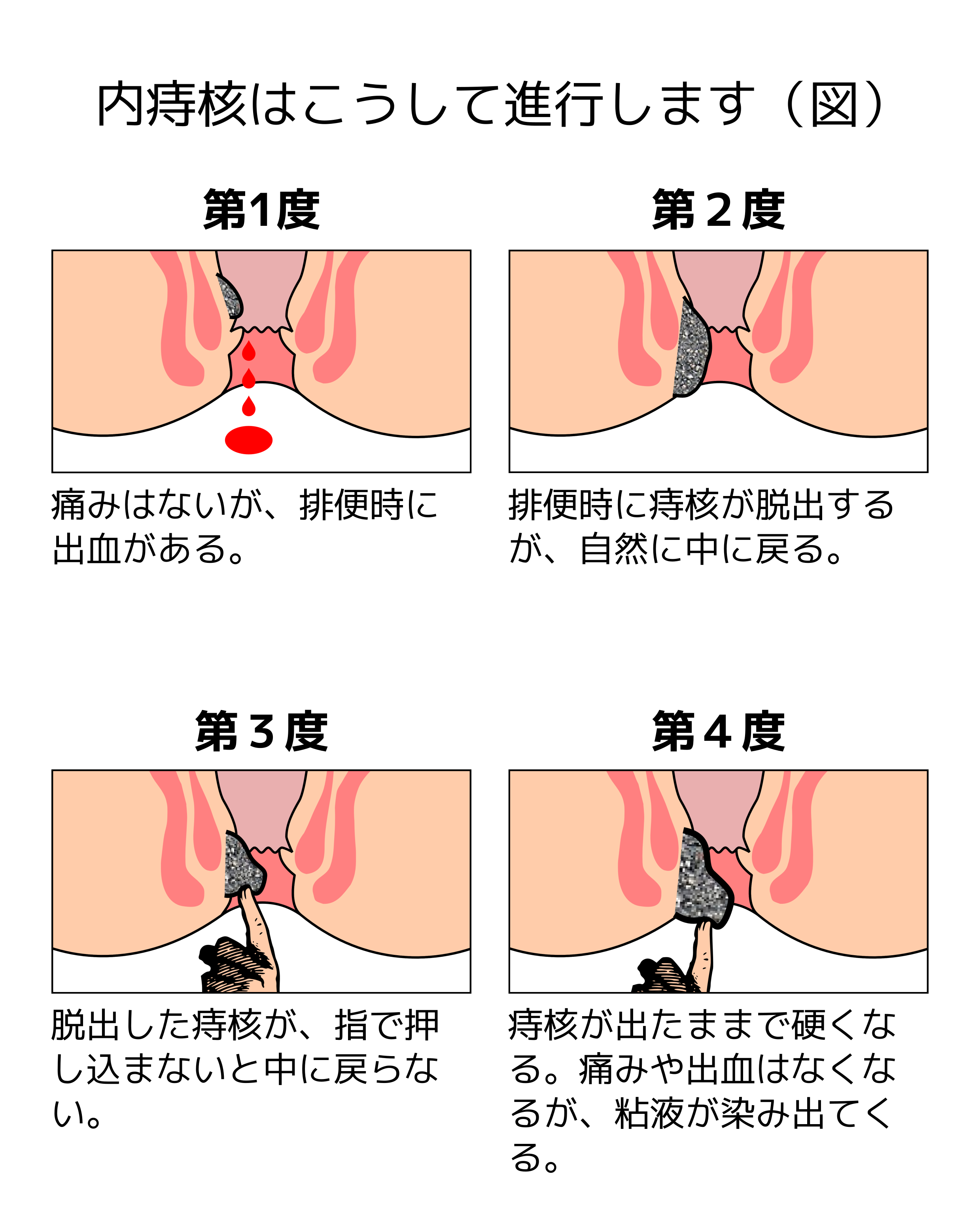 医療法人社団創造会 メディカルプラザ平和台病院 千葉県我孫子市 肛門外科